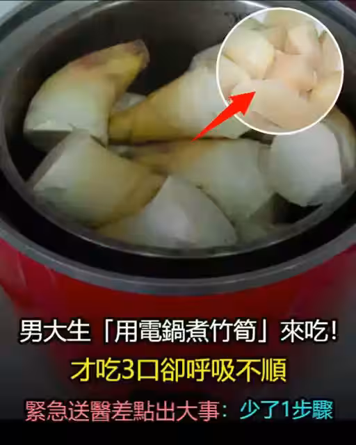 /www/bananadaily.net/web/images/image/2274/22747977.avif
